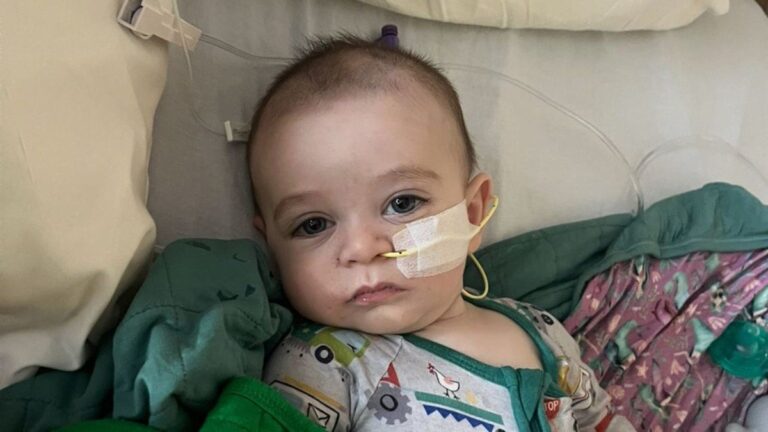 Confirman más de 50 contagios en bebés por un brote de botulismo en EEUU